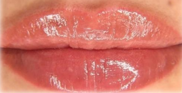 NEUTRALIZACION LABIAL